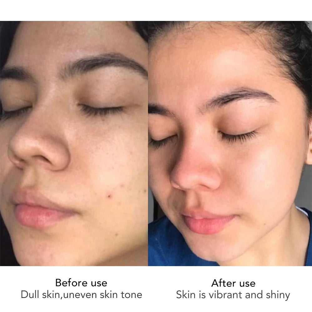 AILKE Lightening Face Cream Antioxidant Radiant Skin Firming Sodium Hyaluronate