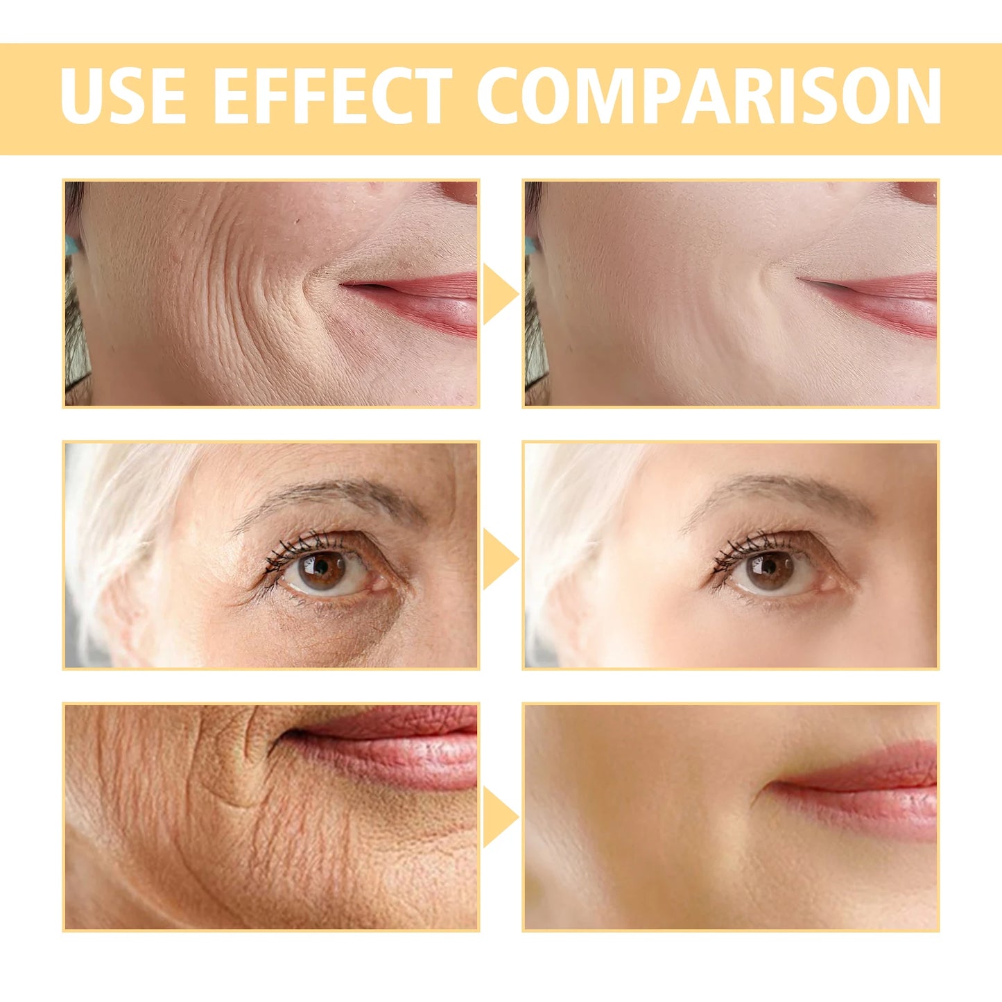 Eelhoe Retinol Anti Wrinkle Cream For Facial Lifting And Brightening