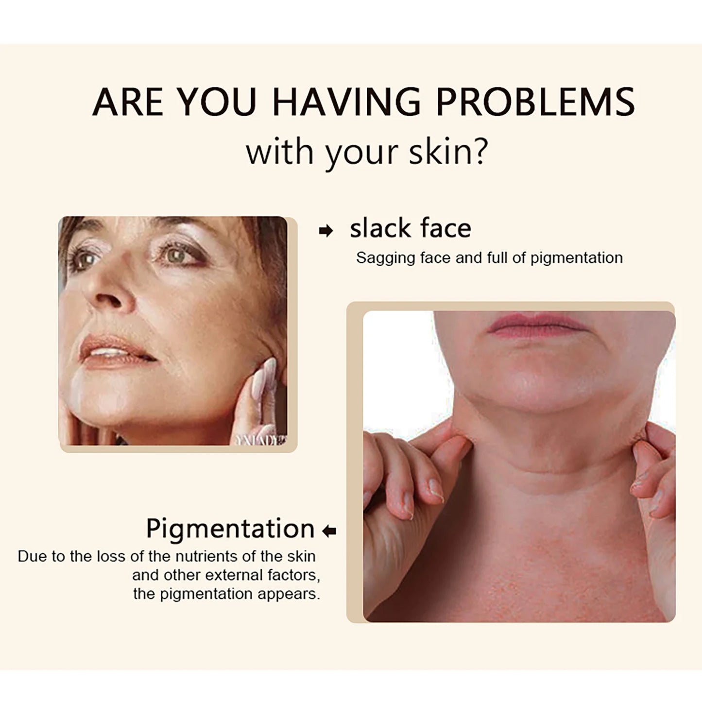 KYLIEFIT Collagen Whitening Essence For Bright Even Skin Tone