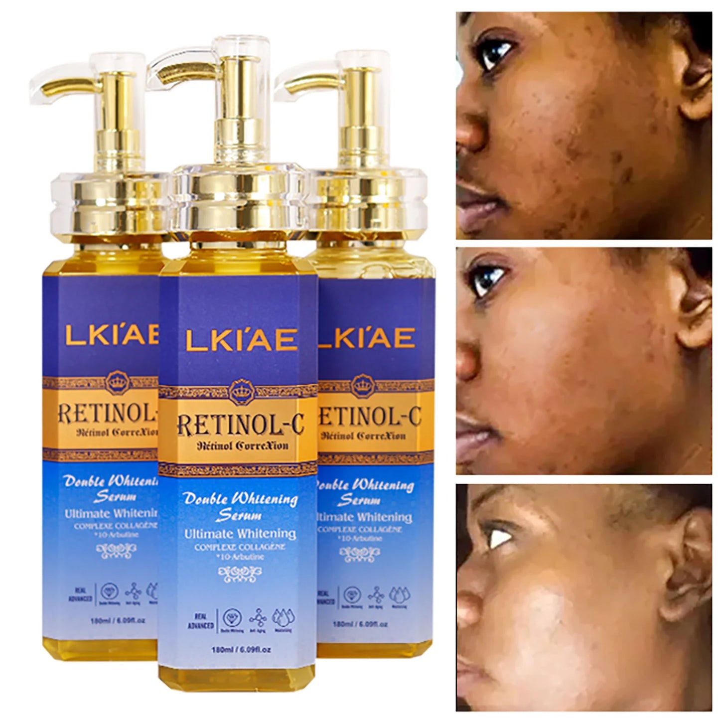 AILKE Retinol Whitening Skin Care Set With Collagen Snail Extract